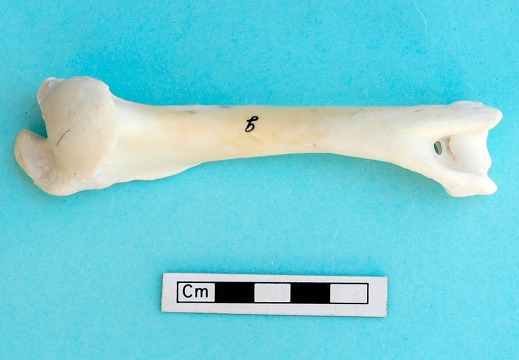 Humerus: posterior view