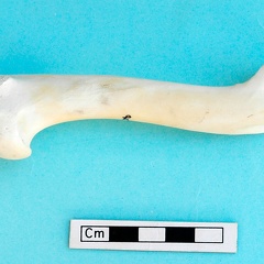 Humerus: medial view