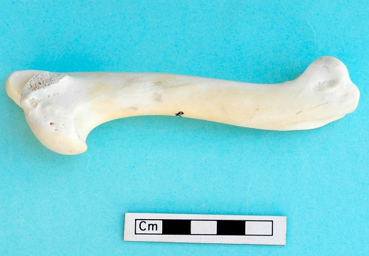 Humerus: medial view