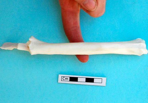  Radius and ulna: anterior view