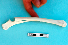 Radius et ulna : vue médiale