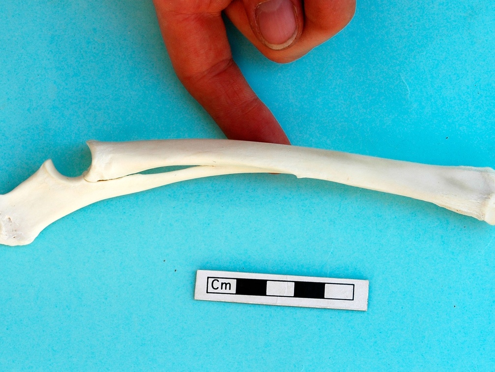  Radius and ulna: medial view