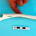 Radius et ulna : vue médiale (19460 visites) Gazella subgutturosa - Mâle - Adulte - Éléments gauchesCollection : Mission syro-japonaise d'Ain ... Radius et ulna : vue médiale
