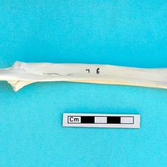 Radius et ulna : vue postérieure