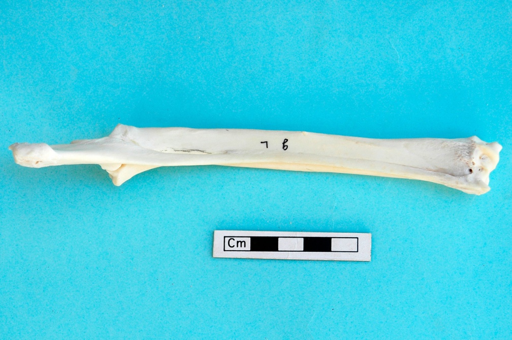 Radius et ulna : vue postérieure