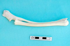 Radius et ulna : vue latérale