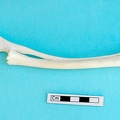 Radius et ulna : vue latérale (21124 visites) Gazella subgutturosa - Mâle - Adulte - Éléments gauchesCollection : Mission syro-japonaise d'Ain ... Radius et ulna : vue latérale