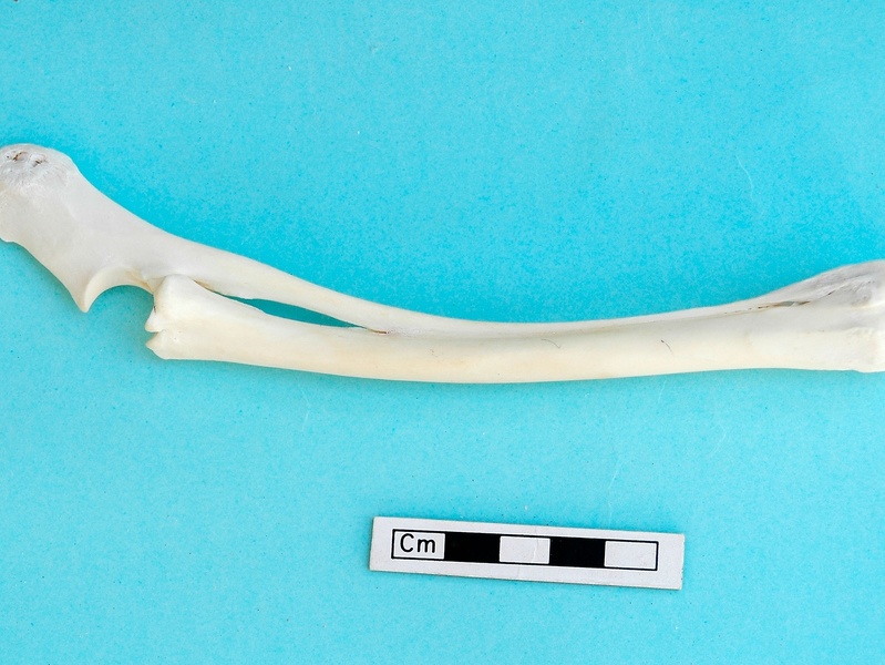  Radio y ulna : vista lateral