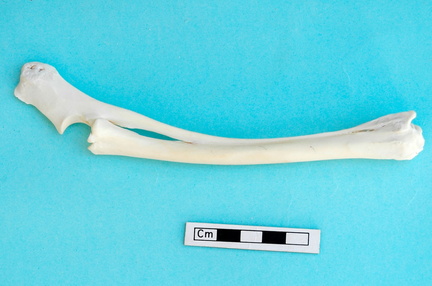 Radius et ulna : vue latérale
