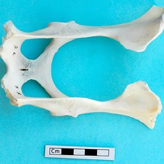 Pelvis : vue dorsale