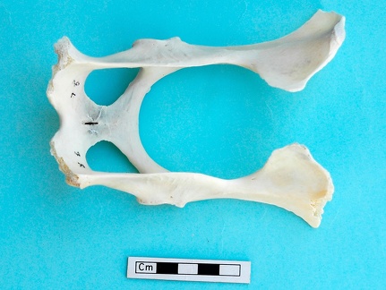 Pelvis : vue dorsale