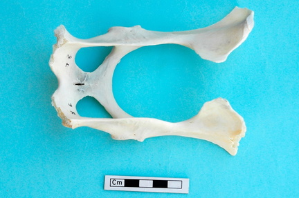 Pelvis : vue dorsale