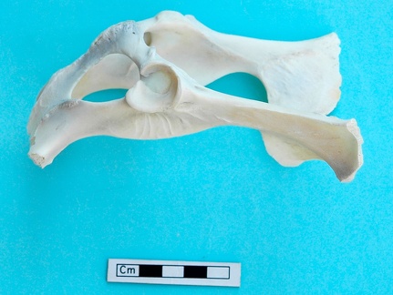 Pelvis: lateral left