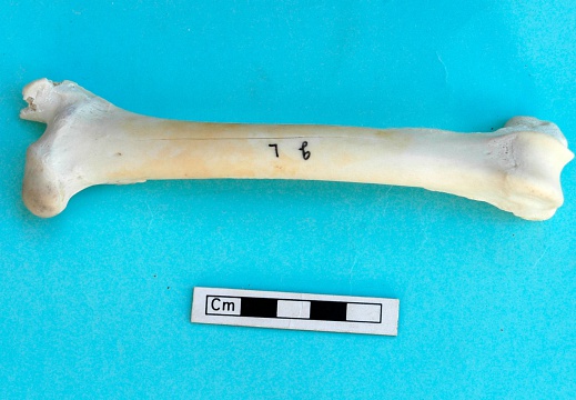 Femur: anterior view