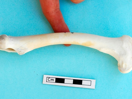 Femur: medial view