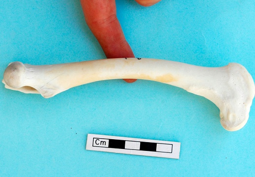 Femur: medial view