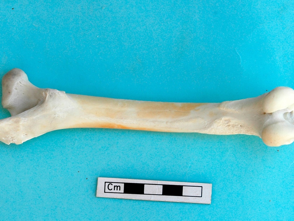 Femur: posterior view