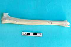 Tibia : vue antérieure
