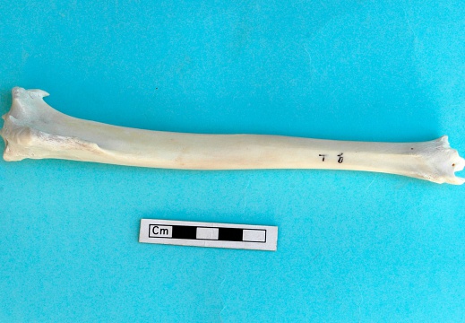 Tibia: anterior view