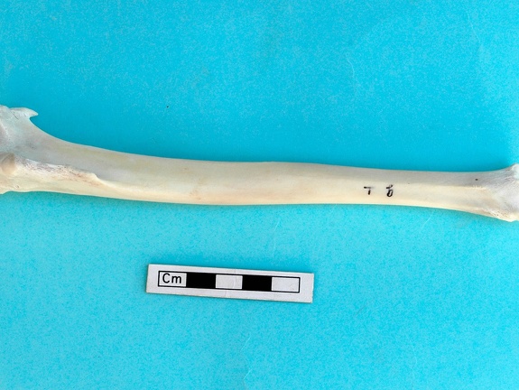 Tibia : vista anterior