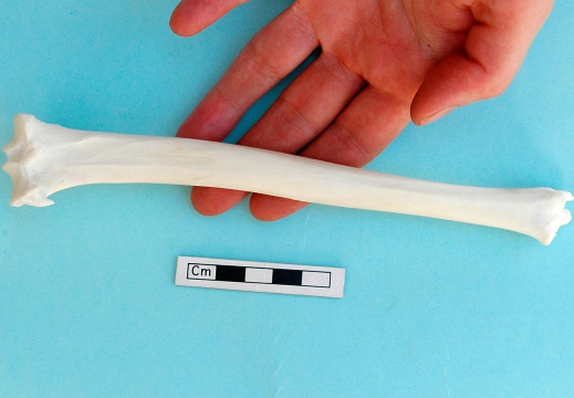 Tibia : vista posterior