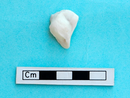 Patella: anterior view