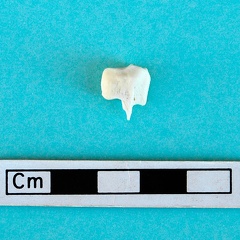 Malleolar bone: side view