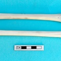 Métacarpe et métatarse : vue antérieure (20470 visites) Gazella subgutturosa - Mâle - Adulte - Éléments gauchesCollection : Mission syro-japonaise d'Ain ... Métacarpe et métatarse : vue antérieure