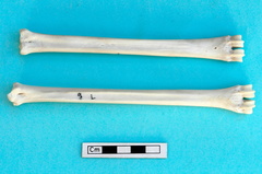  Metacarpo y metatarso : vista posterior