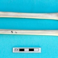 Métacarpe et métatarse : vue postérieure (19819 visites) Gazella subgutturosa - Mâle - Adulte - Éléments gauchesCollection : Mission syro-japonaise d'Ain ... Métacarpe et métatarse : vue postérieure