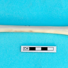 Metacarpus: anterior view