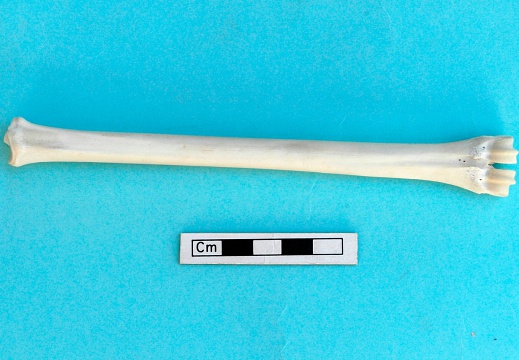 Metatarsus: anterior view