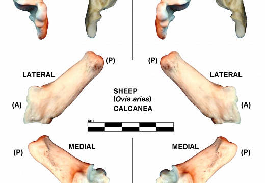 Right and left calcanea