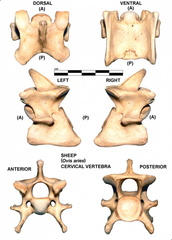Vértebra cervicale