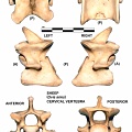 Cervical vertebra