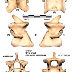 Vértebra cervicale