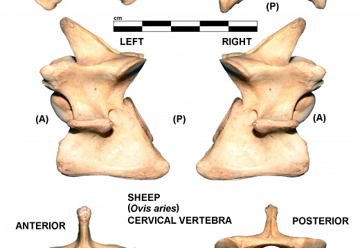 Vértebra cervicale