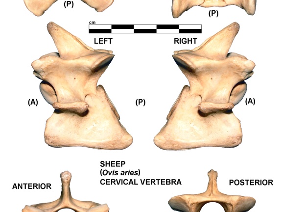 Vertèbre cervicale