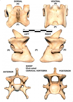 Vértebra cervicale