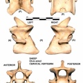 Ovis-Cervical-Verebra.jpg