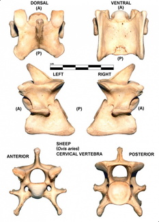 Vértebra cervicale