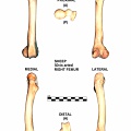 Right femur