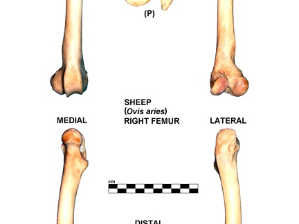 Right femur