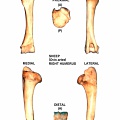 Humérus droit