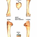 Ovis-Humerus-Right.jpg