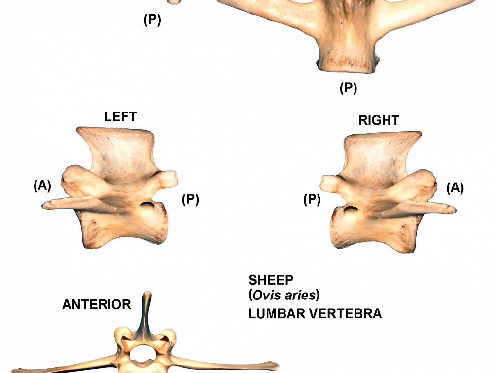 Lumbar vertebra