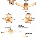 Lumbar vertebra