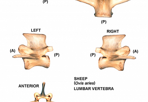 Lumbar vertebra