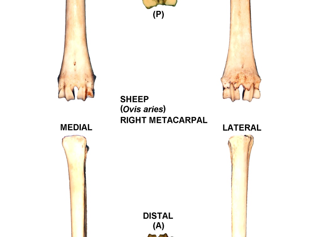 Right metacarpal