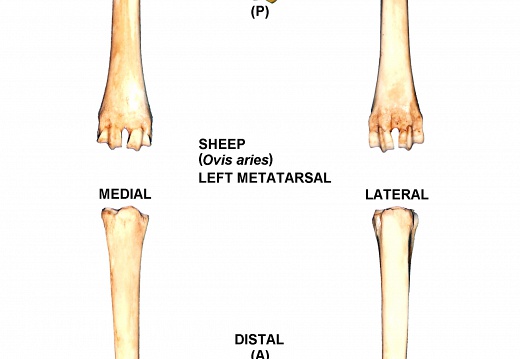 Metatarso izquierdo